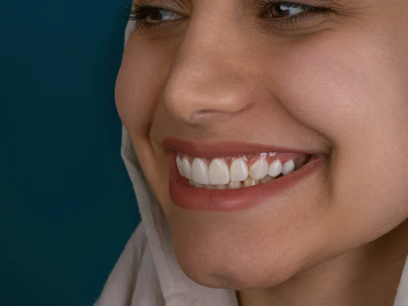 Teeth Whitening